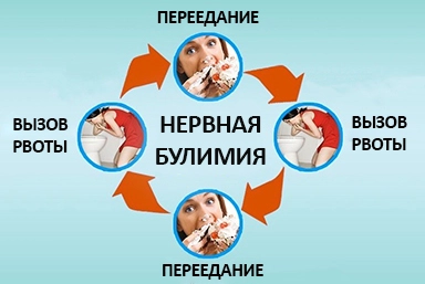 Лечение булимии в Алдане